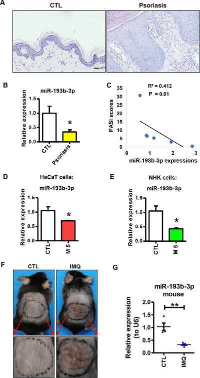 miR-193b-3p 在银屑病角质形成细胞中下调