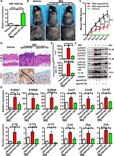 agomiR-193b-3p 在 IMQ 诱导的银屑病小鼠模型中的功能。