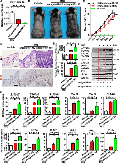 antagomiR-193b-3p 在 IMQ 诱导的银屑病小鼠模型中的作用。