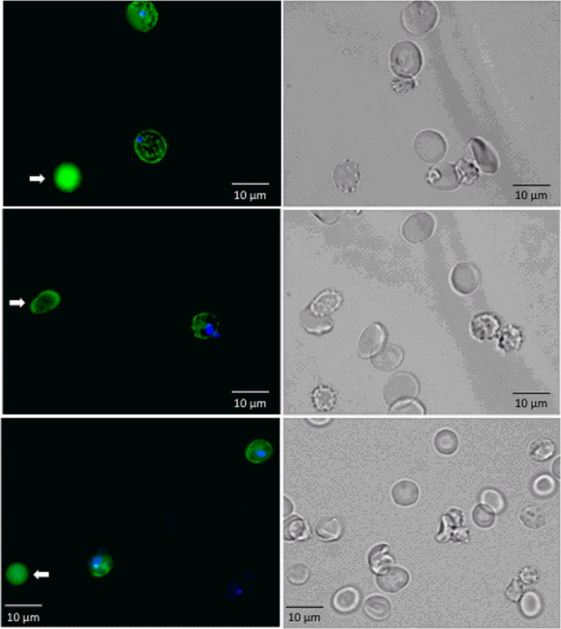 mimic spleen microfluidics