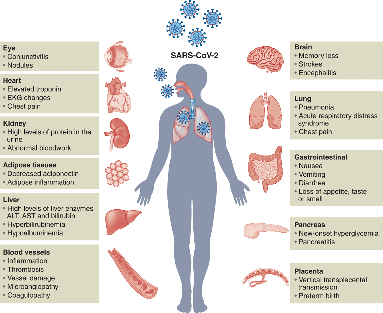 用于研究 SARS-CoV-2 的类器官